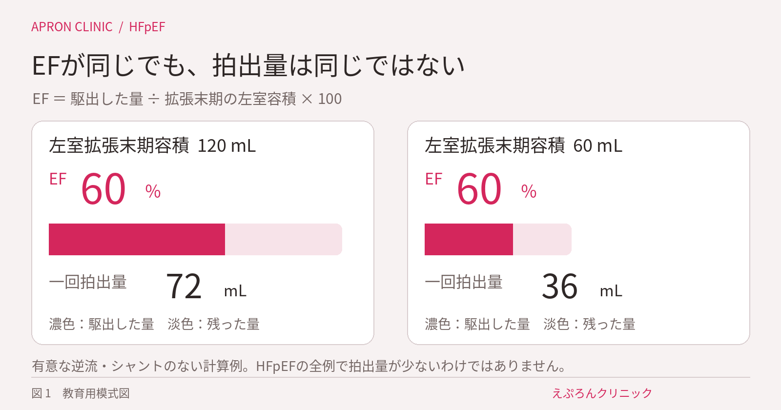 EFがどちらも60％でも、左室容積が異なれば一回拍出量は72mLと36mLに分かれる計算例