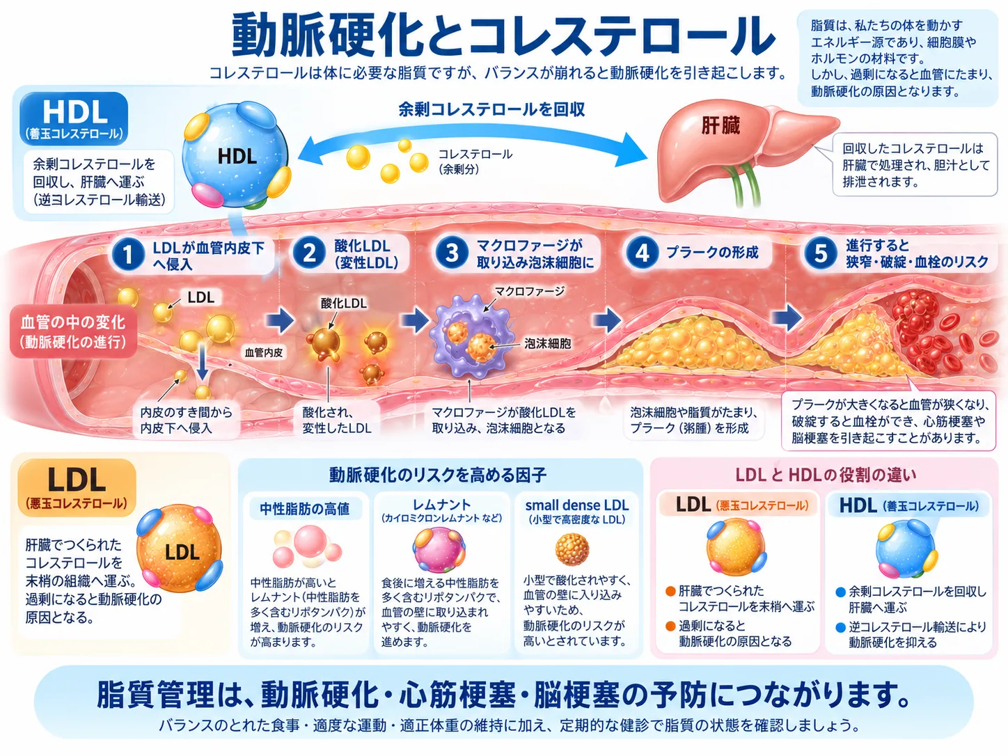 LDL・HDLの違い｜コレステロールを図解 ｜ えぷろんクリニック