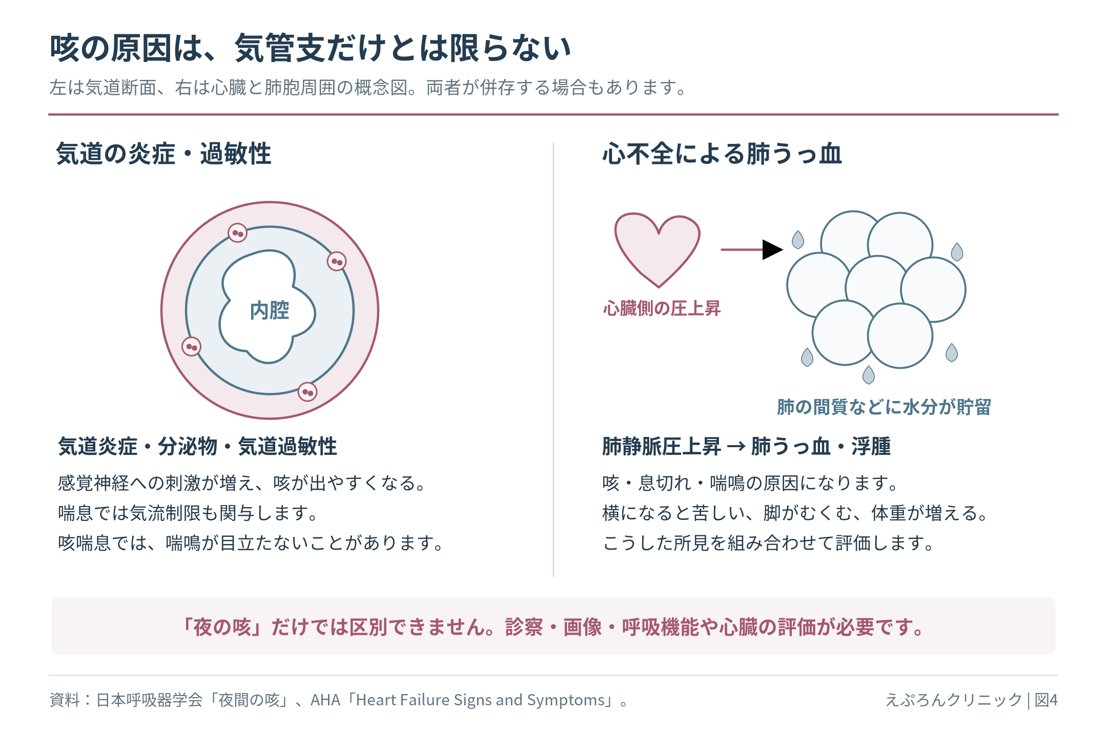 喘息などの気道炎症による咳と、心不全で肺静脈圧が上がり肺に水分が貯留して生じる咳を対比した図。